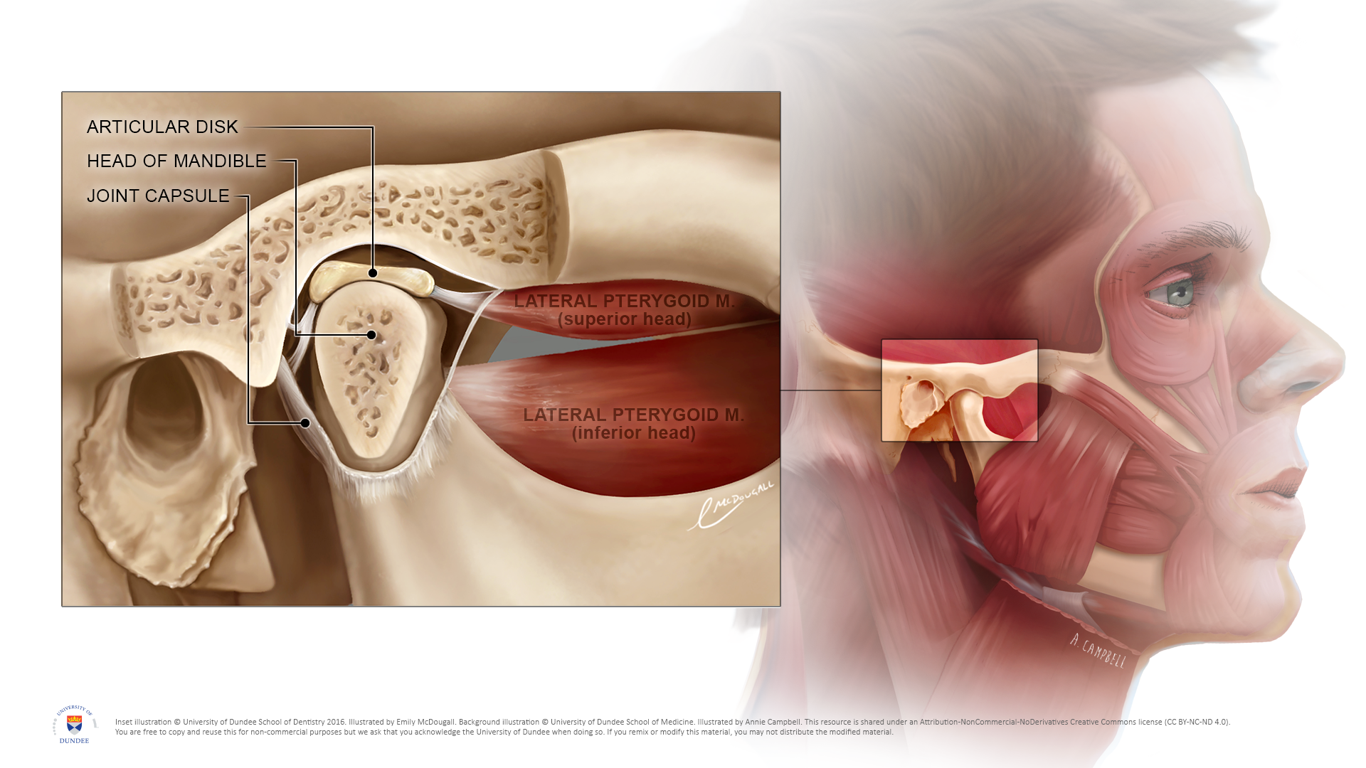 TMJ (temporomandibular joint) illustration and surrounding muscles