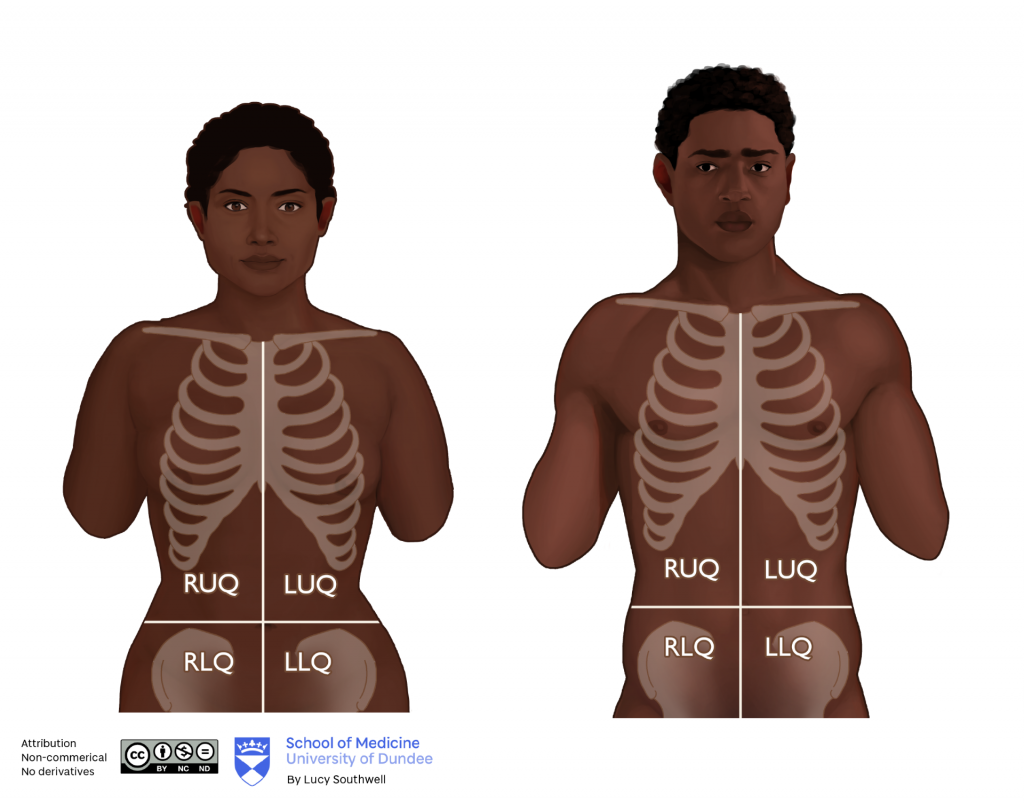 Black female and male - abdominal quadrants 