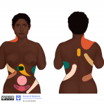 Black female - referred pain regions
