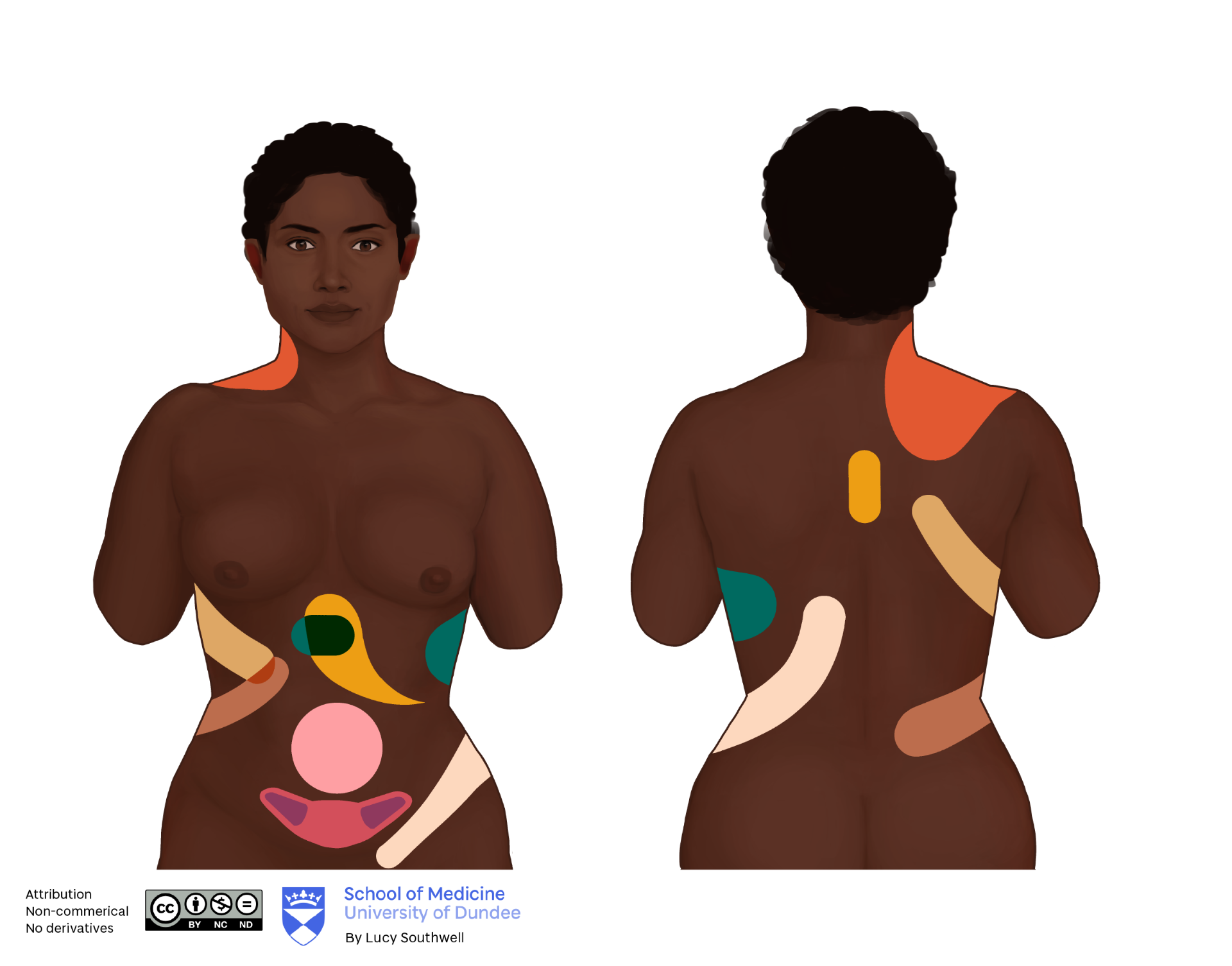 Black female - referred pain regions 