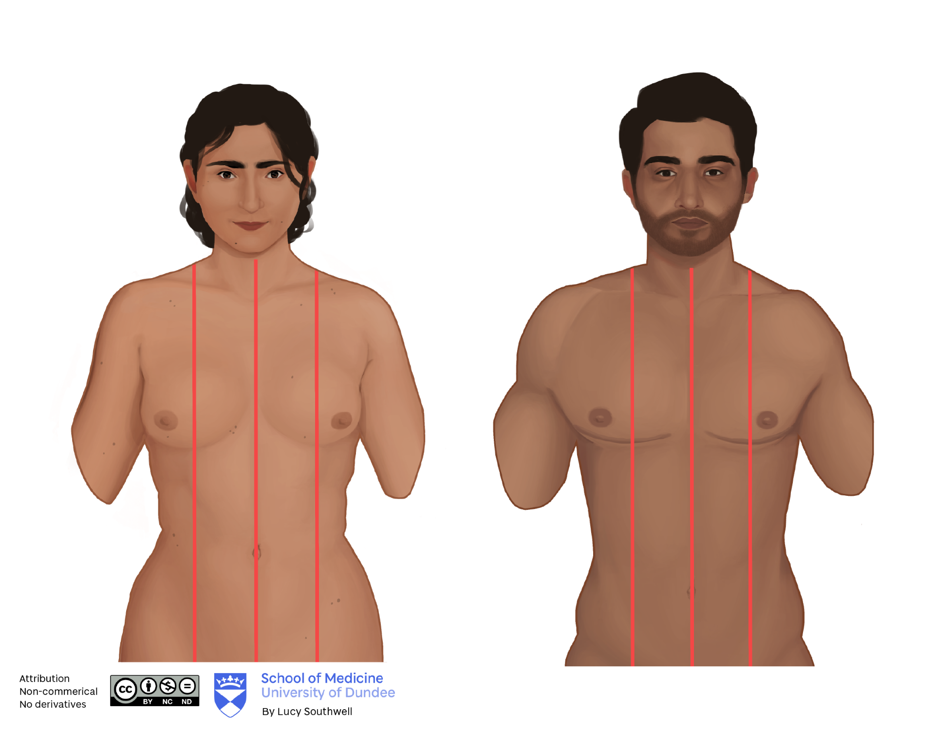 Asian female and male - midclavicular and anterior median lines