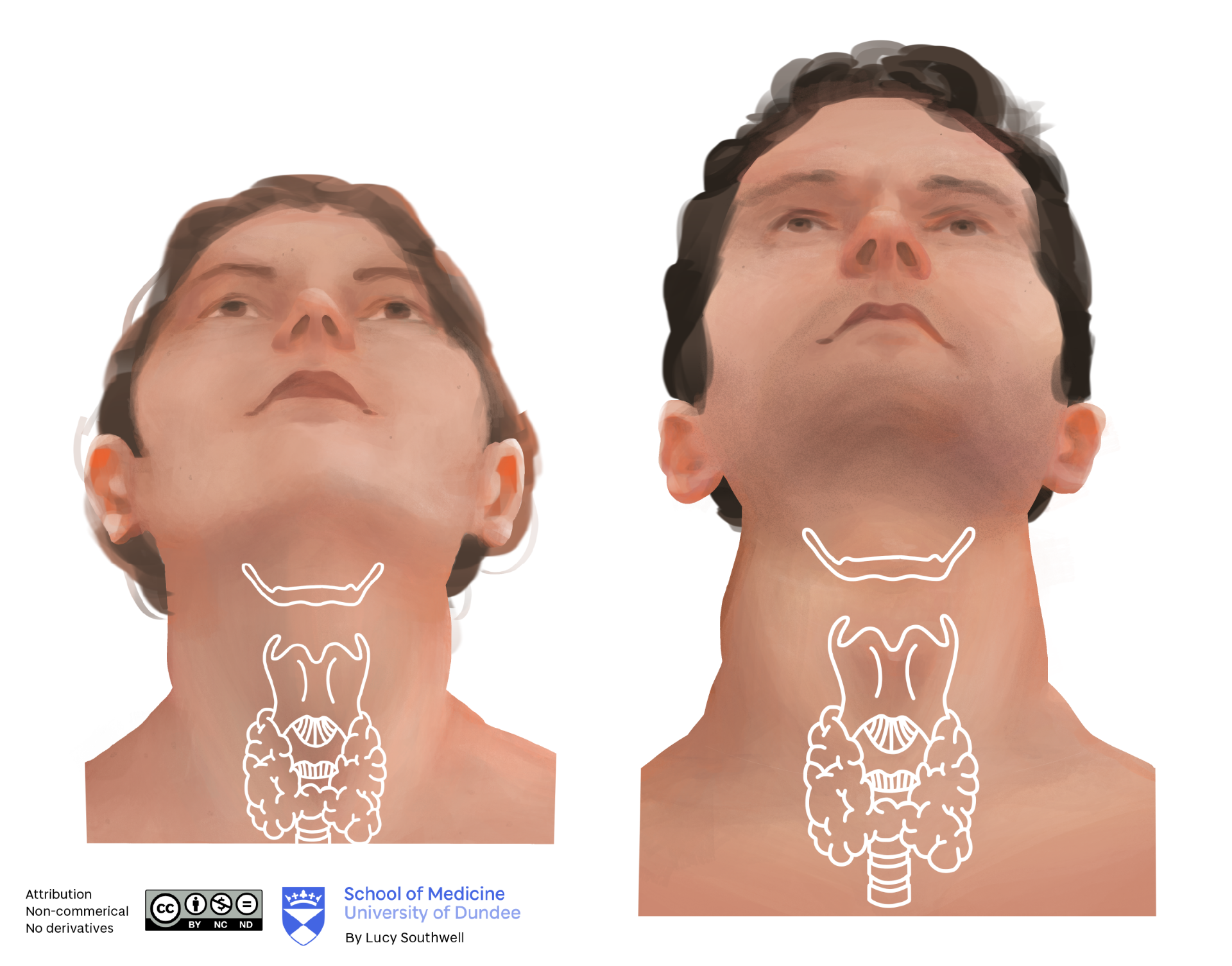 Female and male - larynx, hyoid, trachea, thyroid