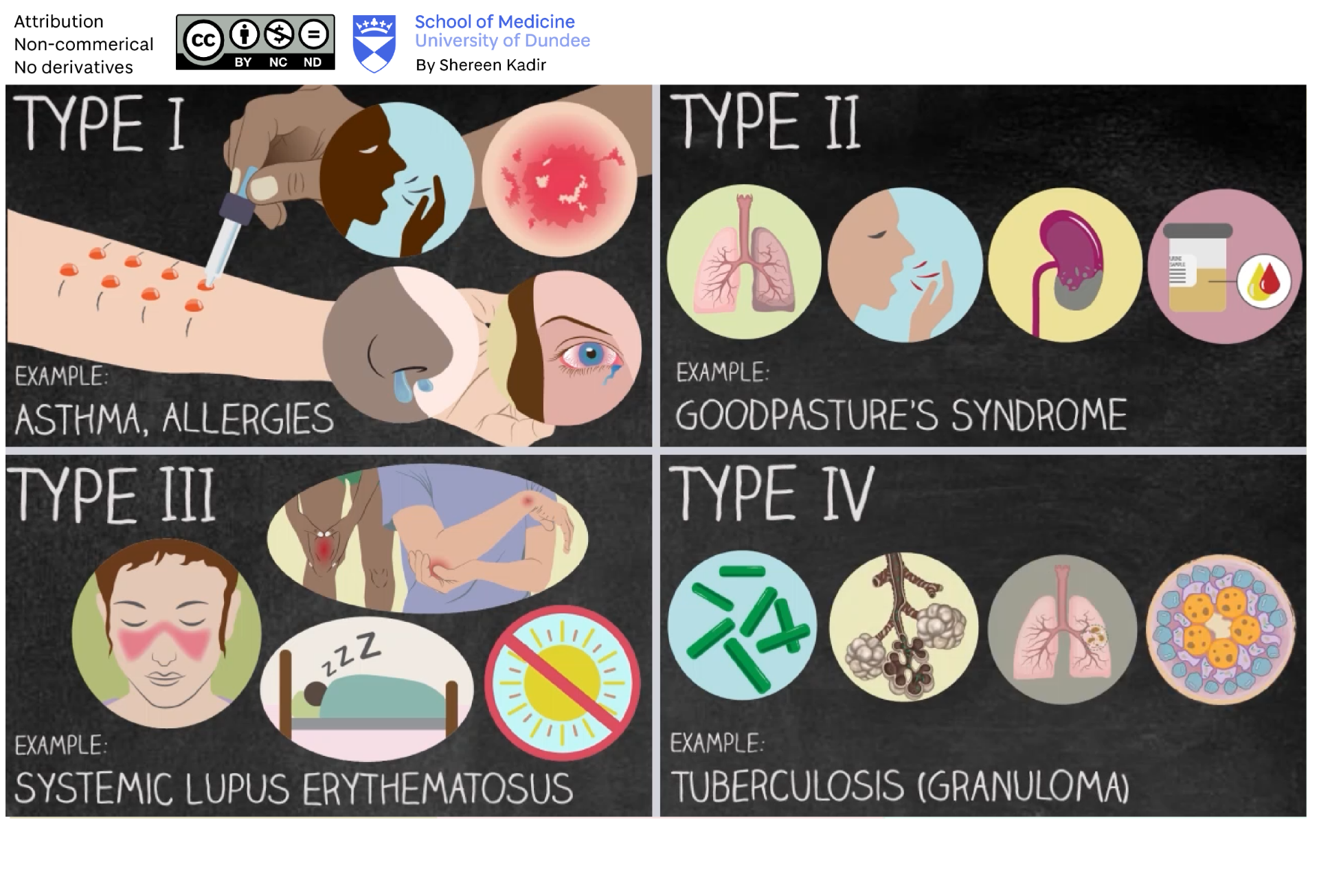 Screen capture of hypersensitivity types sequence