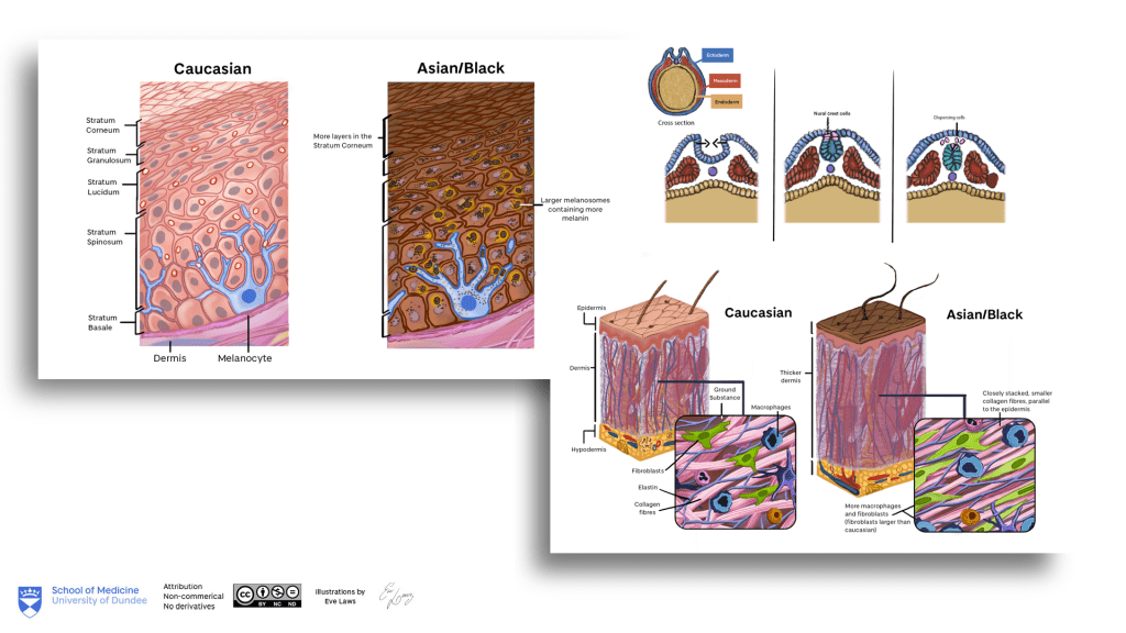 Dermatology illustration drafts 