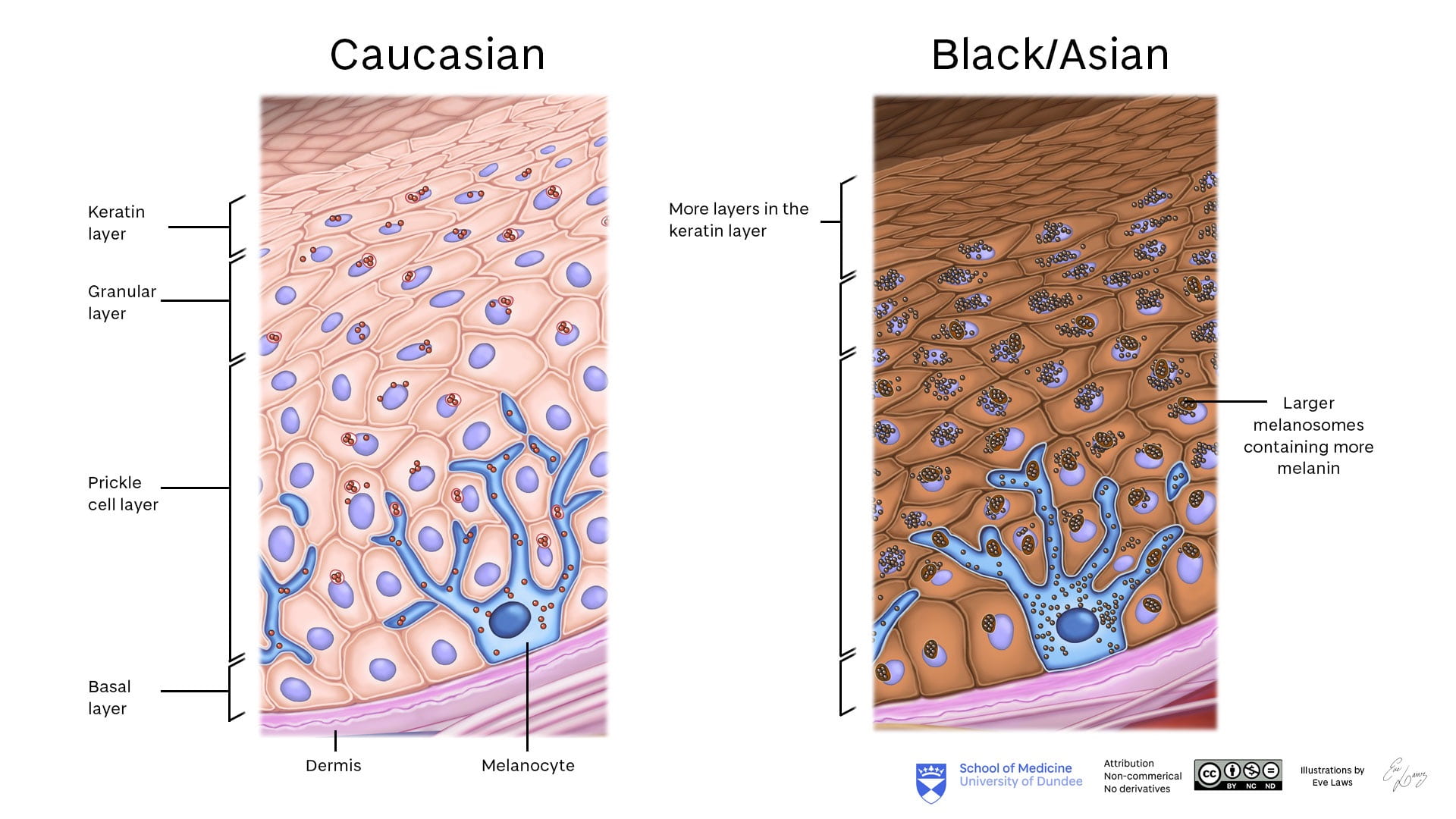 Melanin production in caucasian v asian/black skin